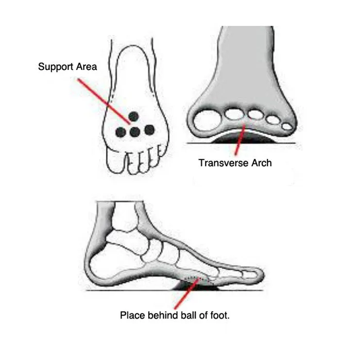 Pedag Metatarsal Pad